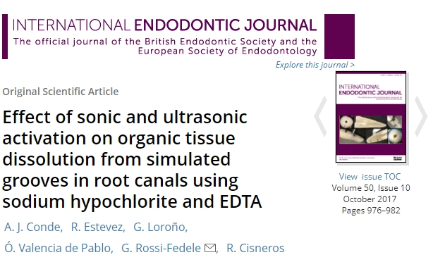 El Dr. Conde publica en el International Endodontic Journal