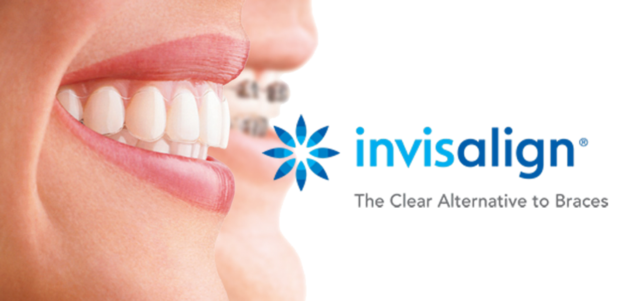 Invisalign® (Ortodoncia Invisible)